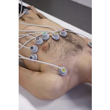 syst�me aspiration appareil ecg