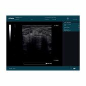 Echographe portable Edan DUS60 avec 2 sondes Echographe portable Edan DUS60 avec 2 sonde