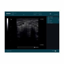 Echographe portable Edan DUS60 (sonde au choix) Echographe portable Edan DUS60